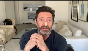 Hugh Jackman da negativo en biopsia que detecta cáncer de piel: "Seguiré hablando de esto"