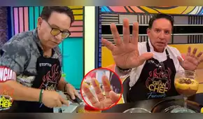 Así quedaron las manos de Ricardo Rondón tras quemaduras en "El gran chef": "Soy duro de matar" Así quedaron las manos de Ricardo Rondón tras quemaduras en "El gran chef": "Soy duro de matar"