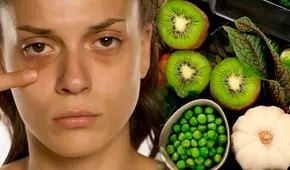 ¿Quieres prevenir ojeras y bolsas en los ojos? La solución está en esta PODEROSA vitamina
