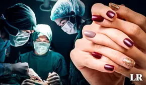 ➤Las razones por las que no debes llevar uñas pintadas a sala de operaciones