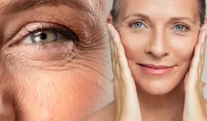 Esta es la fruta que puede ayudarte a disminuir las líneas de expresión y las arrugas