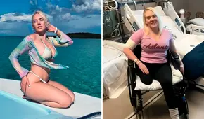 Modelo sufre amputación de una pierna tras contraer letal bacteria en sus vacaciones en Bahamas