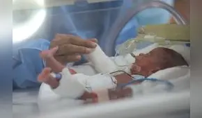 Ocho por ciento de los niños que nacen en el Perú lo hacen de manera prematura
