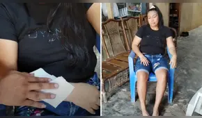 Mujer tiene rara enfermedad en Loreto: transpira sangre por diferentes partes del cuerpo