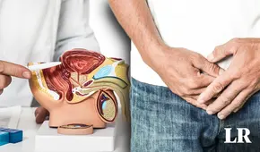 El cáncer de próstata es la primera causa de muerte de los hombres en Perú: ¿cómo prevenirlo?