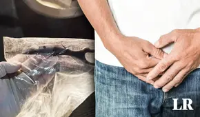 Mujer amputa el pene de su novio en cafetería: le contó que había tenido 50 parejas sexuales