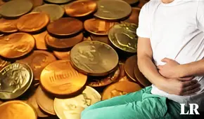 Hombre se salva de morir tras ingerir 39 monedas y 37 imanes: decía que "el zinc ayuda en el culturismo"
