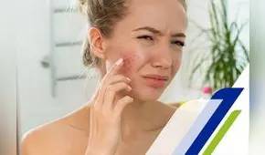 ¿Qué secuelas deja el acné tras el verano intenso?