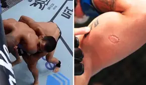 Luchador mordió a su rival, fue expulsado y el dueño de UFC regaló 50.000 dólares al afectado