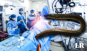 Encuentran una anguila de 30 cm viva en el estómago de un hombre: se introdujo por su recto