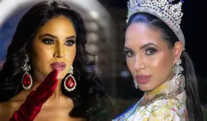 Wilevis Brito, excandidata a Miss Venezuela, falleció a los 24 años tras complicaciones en cirugía