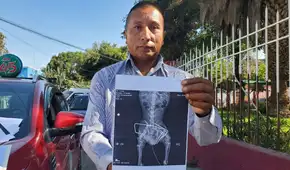 Arequipa: dueño de perro denuncia que veterinaria implantó perno de construcción en columna de mascota Arequipa: dueño de perro denuncia que veterinaria implantó perno de construcción en columna de mascota