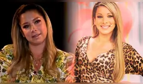 Sofía Franco dio detalles del accidente que sufrió y la razón del por qué no muestra sus brazos en TV