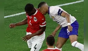 Kylian Mbappé bromea tras fracturarse la nariz: "¿Ideas de máscaras?"