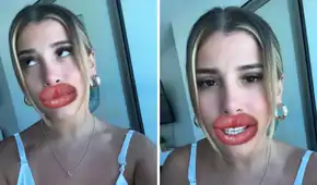 Yahaira Plasencia responde a quienes critican por su retoque estético y usuarios la apoyan: “Para que sigan hablando”