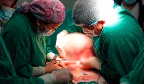 Adulta mayor de 61 años sobrevive a extracción de tumor de más 10kg en hospital de El Agustino