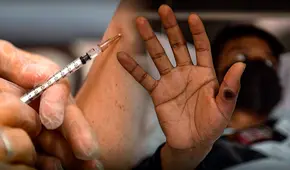 Los casos de mpox en Perú en 2024 y qué se sabe de la vacuna contra el virus, según el Ministerio de Salud