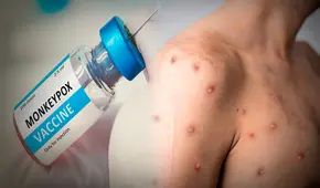 Viruela del mono: ¿Quiénes tienen PRIORIDAD para la vacuna en Estados Unidos por emergencia sanitaria?