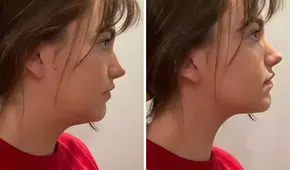 ¿Qué es el 'mewing'? El ejercicio viral de TikTok que promete transformar el rostro: elimina la papada y afina la mandíbula