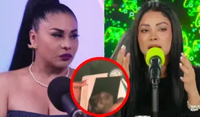 Yolanda Medina ROMPE su silencio y revela la verdad sobre ecografía de Pamela Franco: "Es demasiado"