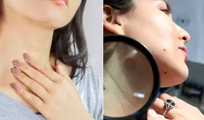 Líneas en el cuello: ¿es un signo de envejecimiento, mala salud o algo más? descúbrelo aquí