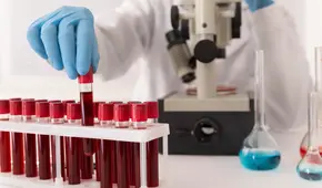 ¿Cómo saber qué tipo de sangre soy? Descubre a qué grupo sanguíneo perteneces y cuál es su significado