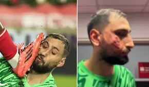 Donnarumma sufrió salvaje patada en el rostro y le pusieron 10 grapas: así quedó la cara del portero del PSG