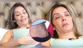 Lucy Bacigalupo fue sometida a nueva operación en la columna tras denunciar negligencia: "Todavía me siento asustada"