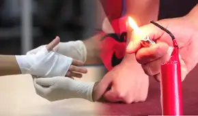 Este error puede empeorar una quemadura: aprende a realizar primeros auxilios ante accidentes en Navidad Este error puede empeorar una quemadura: aprende a realizar primeros auxilios ante accidentes en Navidad