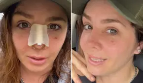 Yiddá Eslava comparte el resultado de su rinoplastia y explica por qué lo mantuvo en secreto: "Cambió mi vida"