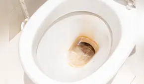 El truco definitivo para eliminar el sarro del inodoro con un solo ingrediente que seguro tienes en casa