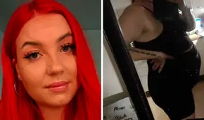 Joven se entera que tenía "cáncer maligno" gracias a accidente en scooter eléctrico: "Tuve suerte de haberme caído"