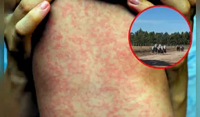 Brote de sarampión en Texas: ¿quiénes son los menonitas y por qué su comunidad está en riesgo en el sur de EE. UU.?