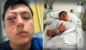 Joven peruano en España casi pierde un ojo tras agresión xenófoba en Madrid: "Nunca me pasó algo como esto"