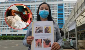 "Mi madre entró por una fractura y terminó sin un dedo": denuncian presunta negligencia médica en hospital Rebagliati