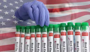 Atención California: ofrecen tarjeta de 25 dólares a ciudadanos que se hagan esta prueba médica