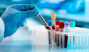 Un estudio médico revela el grupo sanguíneo que posee más tendencia a sufrir problemas al corazón