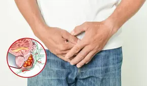 Efectos de la cerveza en la próstata: verdades y mitos explicados por un especialista