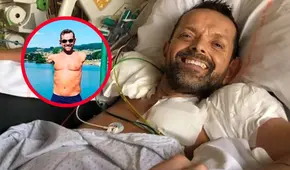 Hombre que perdió los brazos tras descarga eléctrica recibe un trasplante histórico después de 23 años