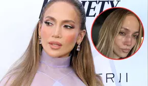 Jennifer López se rompe la nariz al sufrir aparatosa caída en sus ensayos para los AMA 2025: así quedó el rostro de JLO