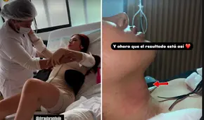 La ‘Uchulú’ impacta con radical cambio tras cirugía para reducirse ‘la manzana de Adán’ y costillas: “Pienso hacerme la voz en Colombia”