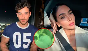 Austin Palao impacta al revelar que no descarta una relación con Vania Bludau: "Conversando, quién sabe" Austin Palao impacta al revelar que no descarta una relación con Vania Bludau: "Conversando, quién sabe"