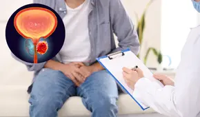 Avances en el diagnóstico y tratamiento del cáncer de próstata: innovaciones clave para mejorar las tasas de éxito