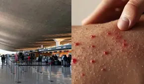 Funcionario de salud de Washington alerta sobre caso de un viajero con sarampión en aeropuerto de Dulles