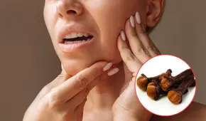 Así puedes usar el clavo de olor para aliviar el dolor dental, combatir bacterias y refrescar el aliento
