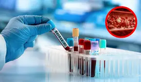 Científicos descubren un nuevo tipo de sangre en una mujer en la isla de Guadalupe: "Es el único caso en el mundo"