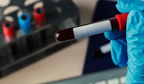 "Solo hay una": científicos descubren un nuevo tipo de sangre, pero le pertenece a una "única persona en el mundo"