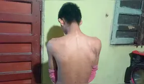 Soldado de 19 años denuncia brutal agresión por parte de sus superiores: ataque ocurrió durante celebración de fiesta de San Juan