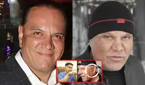 Mauricio Diez Canseco luce radical cambio facial tras someterse a retoques estéticos y Magaly reacciona: "Es otro"