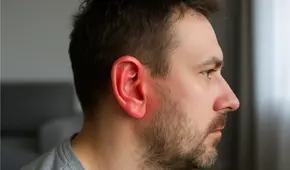 ¿Por qué tu oreja se pone roja y se calienta? Esta es la verdadera razón del enrojecimiento, según especialista